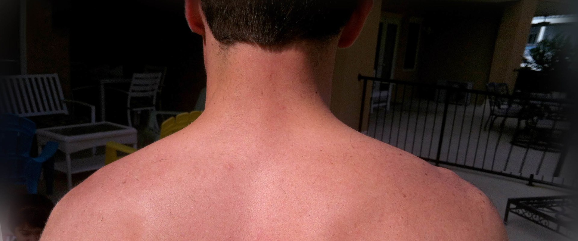 Can Trigger Points Last For Years 