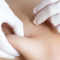 Do Trigger Point Injections Help Relieve Fibromyalgia Pain?