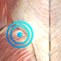 How Long Does It Take for a Trigger Point to Release?