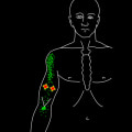 How Long Does Trigger Point Injection Therapy Last?