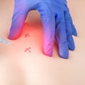Do trigger point injections wear off?