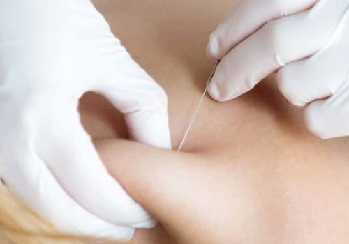 Do Trigger Point Injections Help Relieve Fibromyalgia Pain?