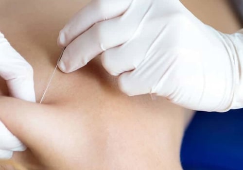 Are Trigger Point Injections Safe and Effective for Pain Relief?