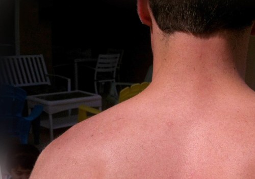 Can Trigger Points Last for Years?