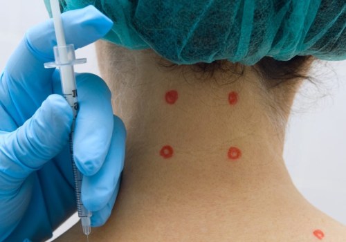 What to Expect from a Trigger Point Injection
